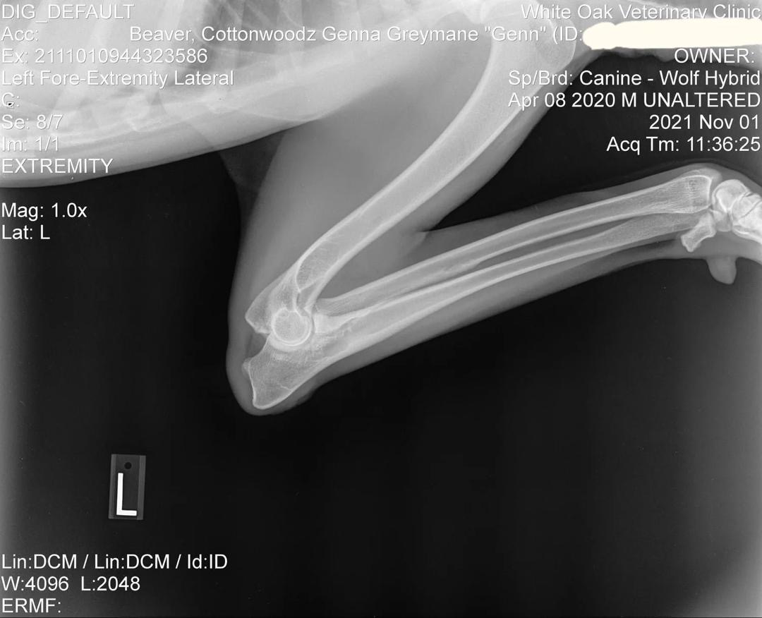 Genn Preliminary Left Elbow X-Ray